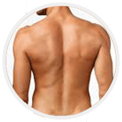 back-hair-removal