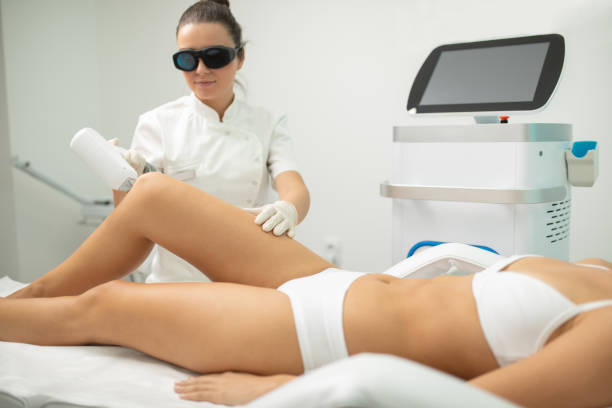 permanent hair removal laser